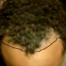 TragicHairline