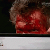 Bloody Vince McMahon